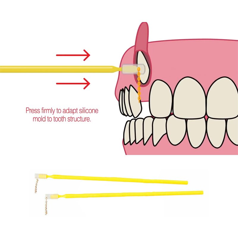 C&C - BASE COMPOSITE CON CADENA DCCO Pequeño Reliance Orthodontic - 1 unidad