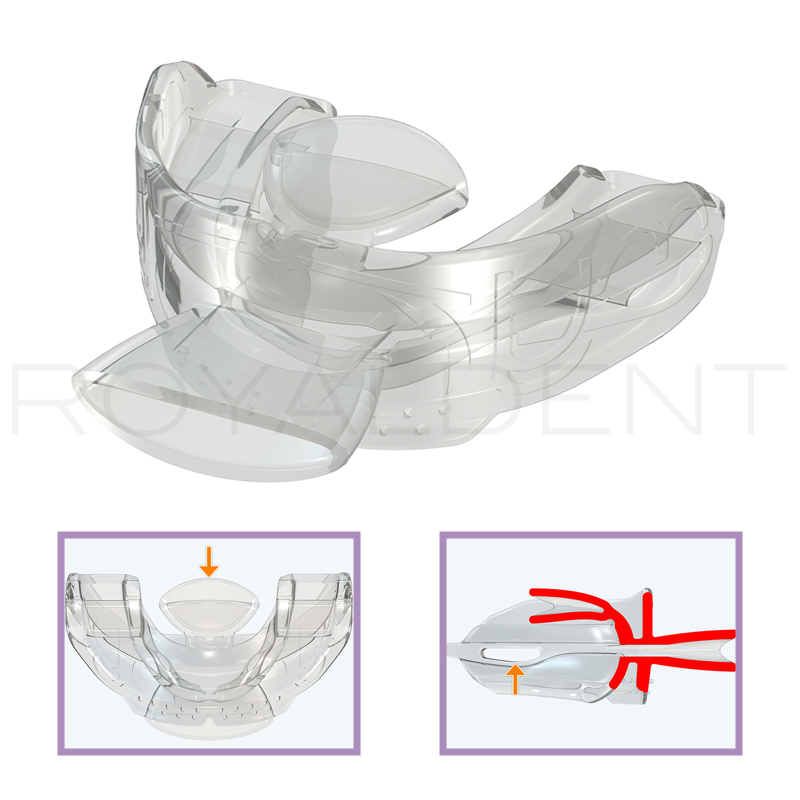 Myotalea® Tongue, Lip & Jaw Appliance - TLJ Myotalea - unidad y para todas las edades